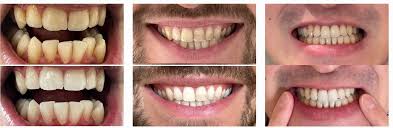 Organic secret Teeth Whiteening Powder